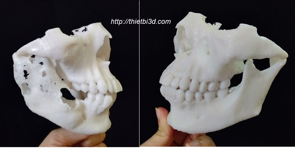 Mô hình xương sọ 3D